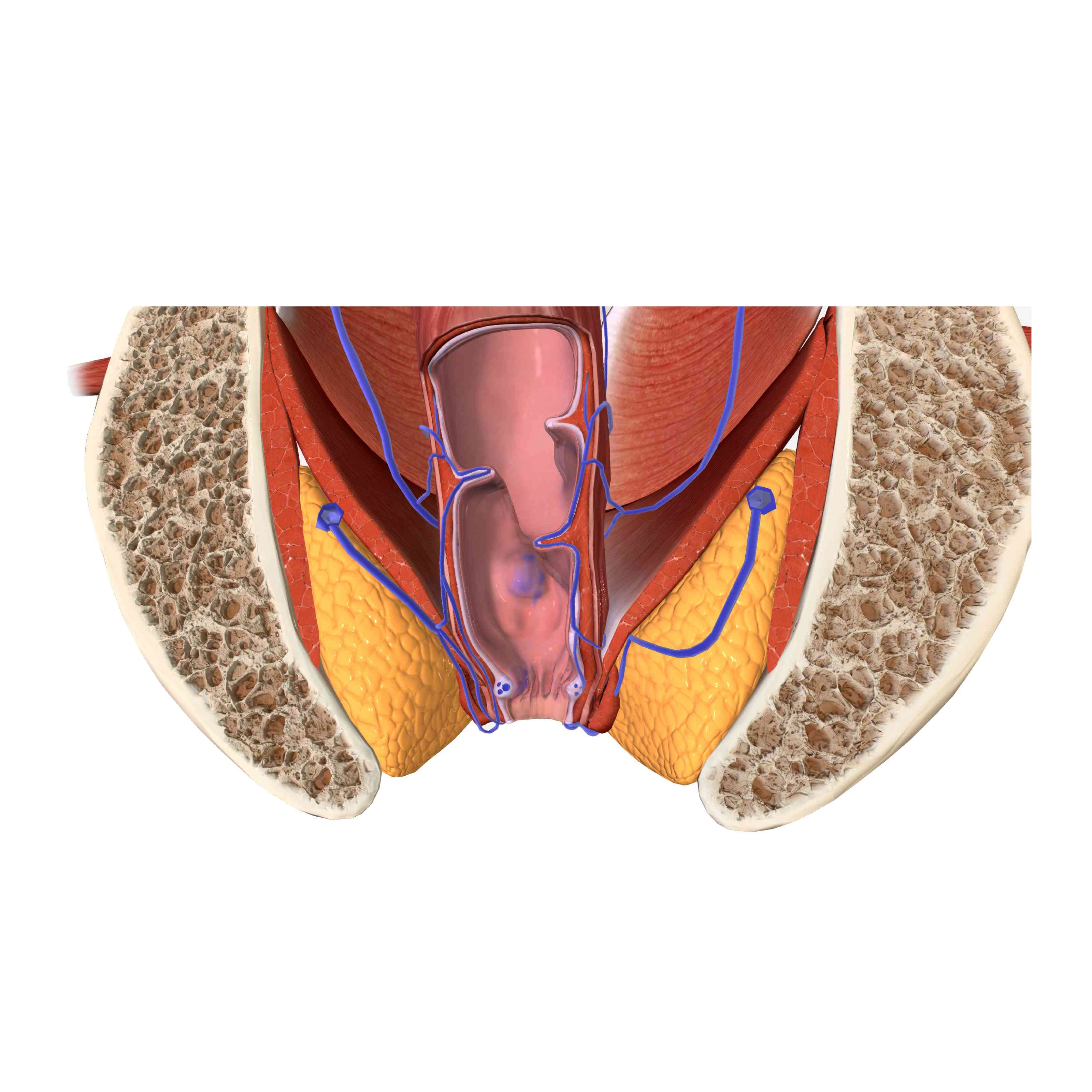 Anal Fistula