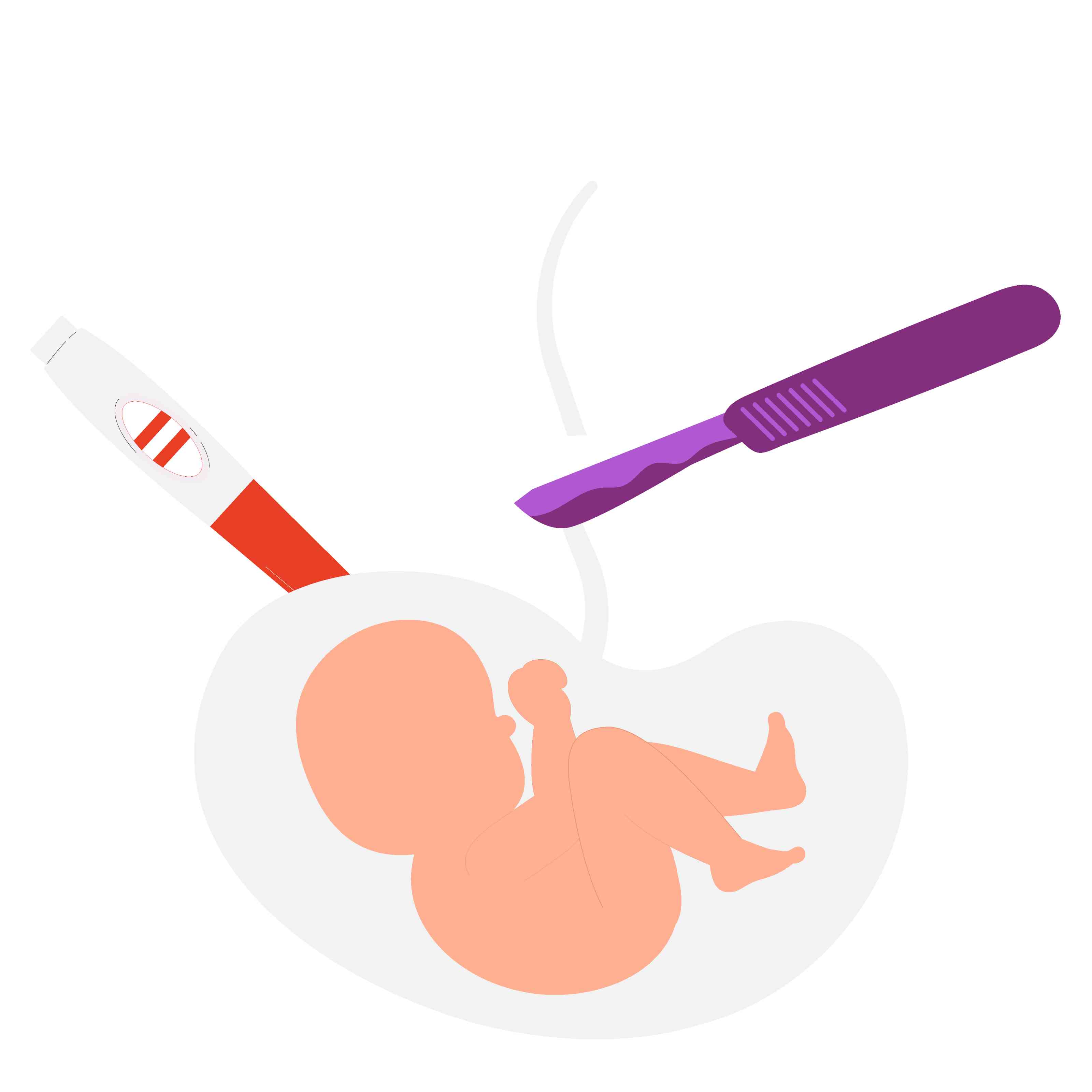 Medical Termination of Pregnancy (MTP)