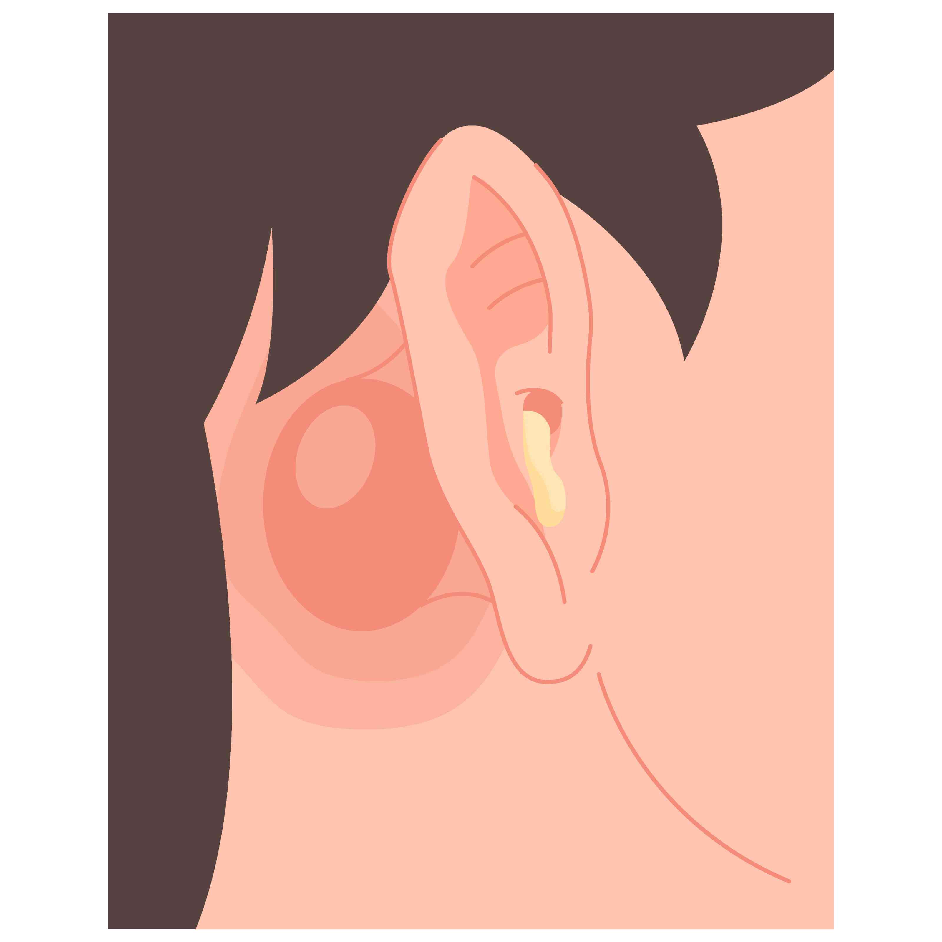 Mastoidectomy